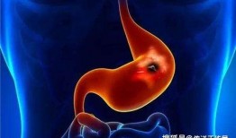 胃溃疡吃瓜吗,瓜类食物的适宜与禁忌